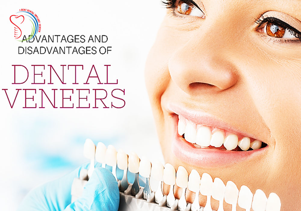 Advantages of dental porcelain veneer